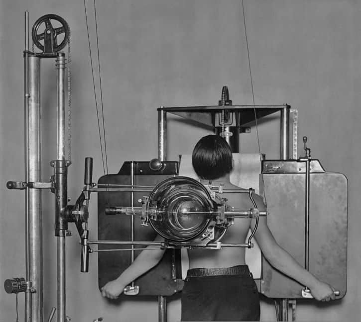 history of radiology - old xray machine